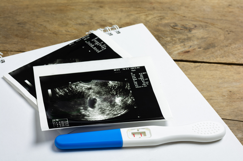 a positive pregnancy test and ultrasound